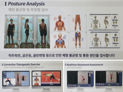 척추측만증 나이를 들면 어떤 합병증이 예상 될까요?